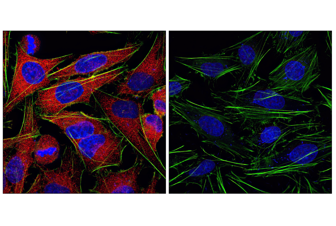 Anti-rabbit IgG (H+L), F(ab')2 Fragment (Alexa Fluor® 555