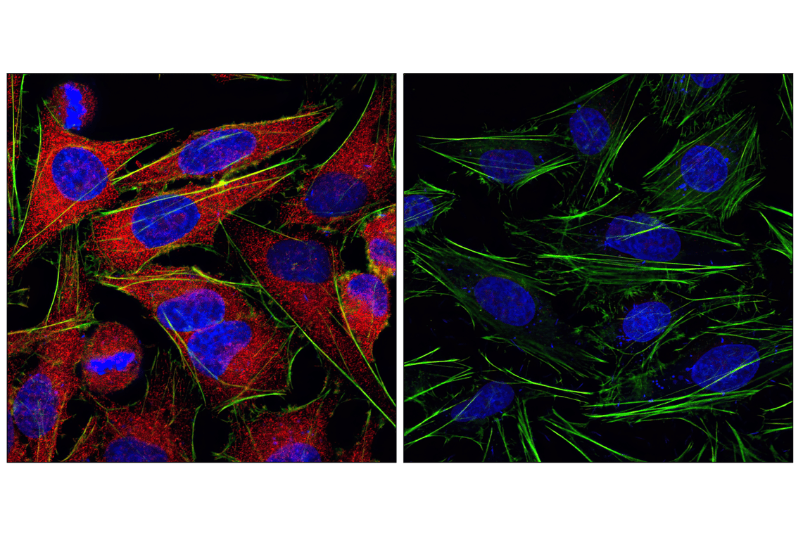 Immunofluorescence Image 1: Anti-rabbit IgG (H+L), F(ab')<sub>2</sub> Fragment (Alexa Fluor<sup>®</sup> 555 Conjugate)