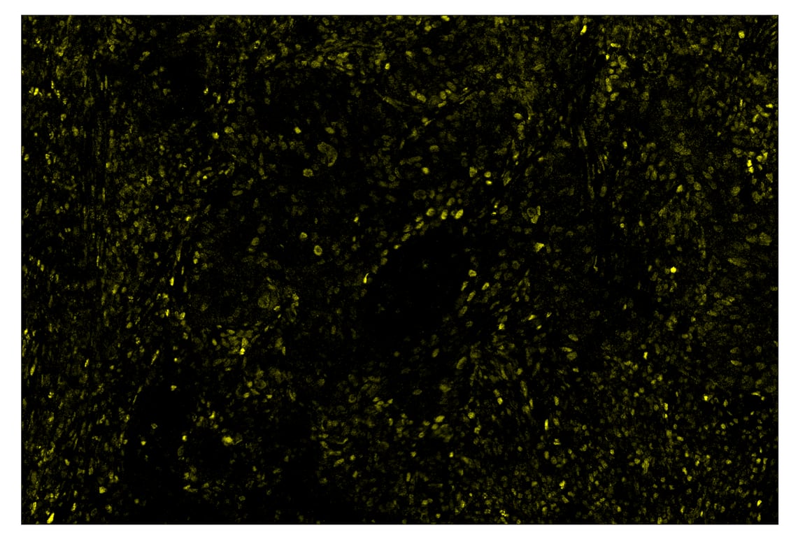 Immunohistochemistry Image 3: Phospho-Stat3 (Tyr705) (D3A7) & CO-0029-488 SignalStar<sup>™</sup> Oligo-Antibody Pair