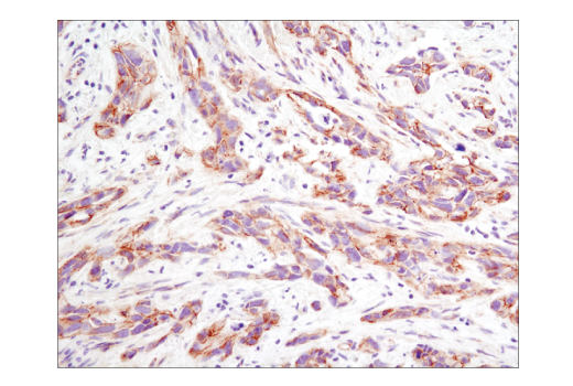Immunohistochemistry Image 2: Non-phospho (Active) beta-Catenin (Ser33/37/Thr41) (D13A1) Rabbit Monoclonal Antibody (BSA and Azide Free)