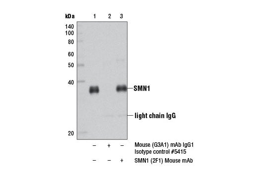 Immunoprecipitation Image 1: SMN1 (2F1) Mouse Monoclonal Antibody