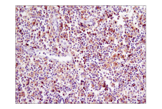 Immunohistochemistry Image 1: Btk (D3H5) Rabbit Monoclonal Antibody (BSA and Azide Free)