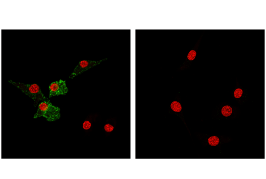 Immunofluorescence Image 1: CD11c (D1V9Y) Rabbit Monoclonal Antibody