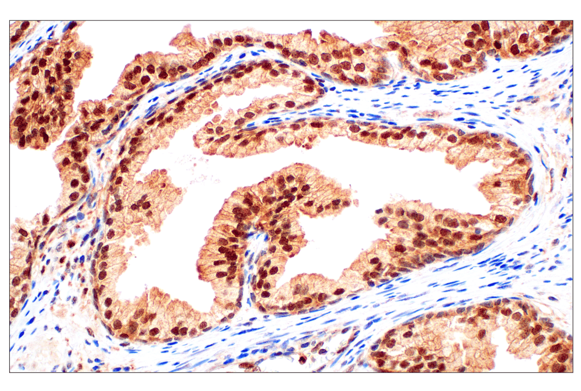 Immunohistochemistry Image 1: Stat3 (124H6) Mouse Monoclonal Antibody