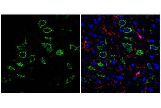 Immunofluorescence Image 2: Osteopontin/SPP1 (E9Z1D) Rabbit Monoclonal Antibody