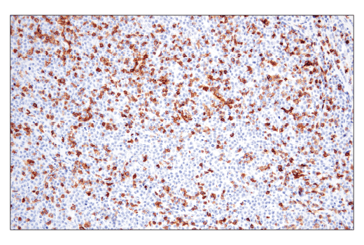Immunohistochemistry Image 5: CD6 (E9Y7Y) Rabbit Monoclonal Antibody