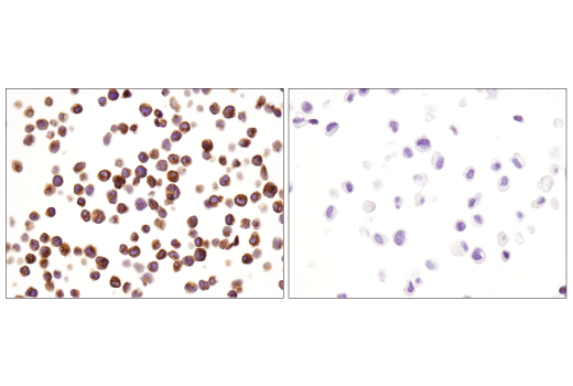 Immunohistochemistry Image 4: CD3 epsilon (D7A6E<sup>™</sup>) Rabbit Monoclonal Antibody (BSA and Azide Free)