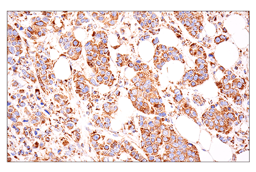 undefined Image 21: Glutamine Metabolism Antibody Sampler Kit