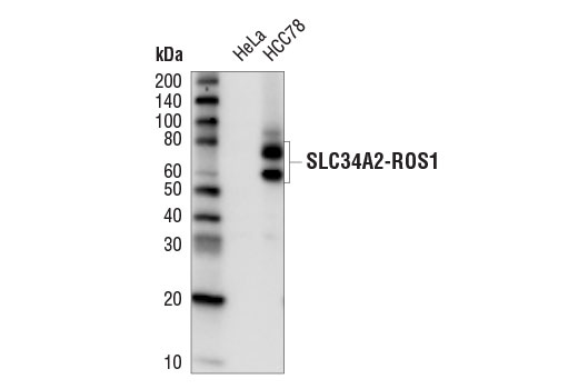 Western Blotting Image 1: ROS1 (D4D6<sup>®</sup>) Rabbit mAb (HRP Conjugate)