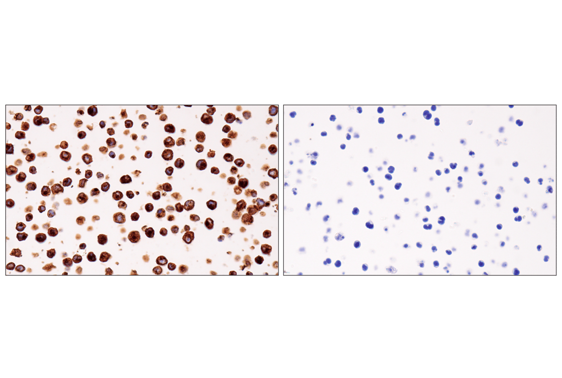 Immunohistochemistry Image 11: HLA-DRA (E9R2Q) Rabbit Monoclonal Antibody (BSA and Azide Free)