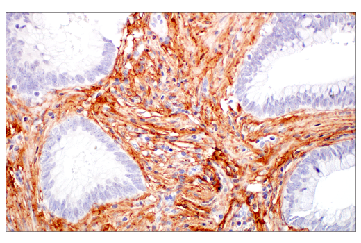 Immunohistochemistry Image 5: COL3A1 (E8D7R) Rabbit Monoclonal Antibody