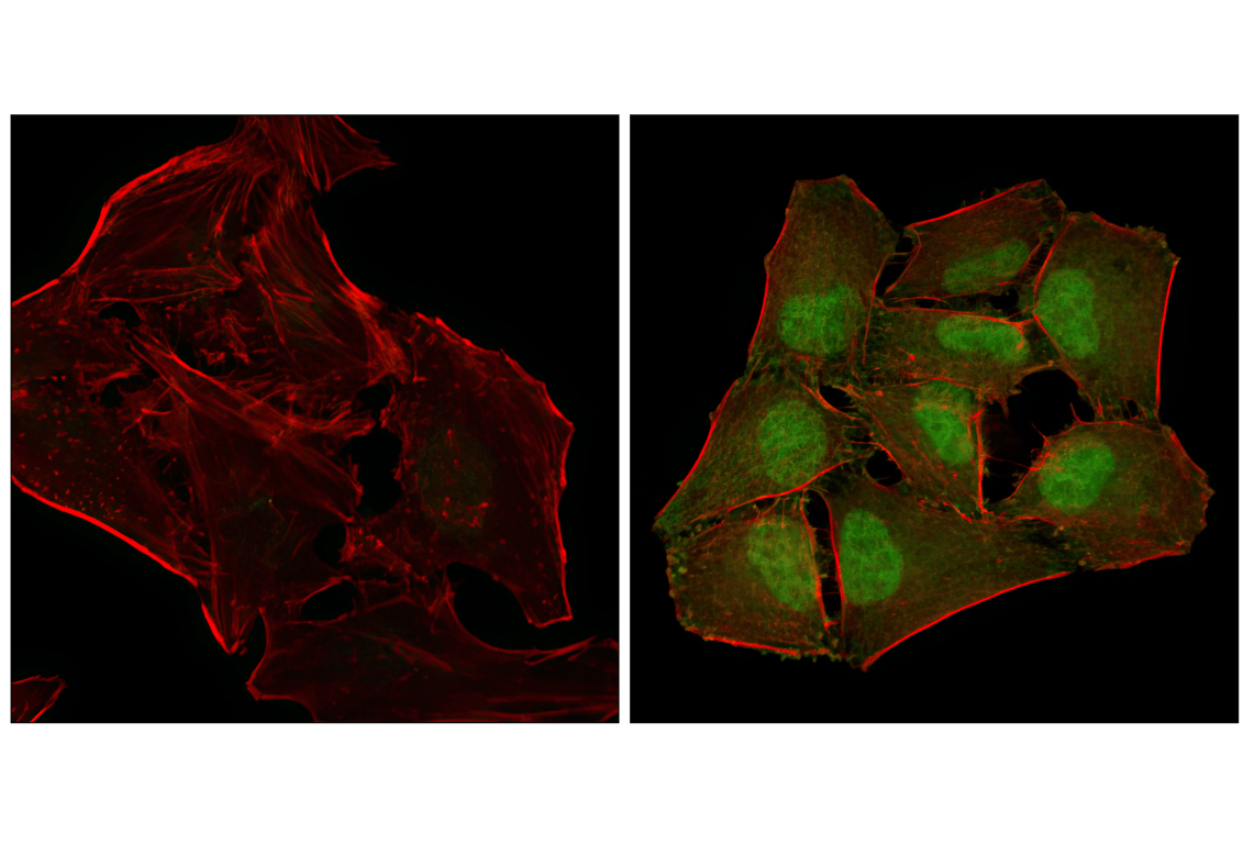 Immunofluorescence Image 1: Phospho-p38 MAPK (Thr180/Tyr182) (3D7) Rabbit Monoclonal Antibody