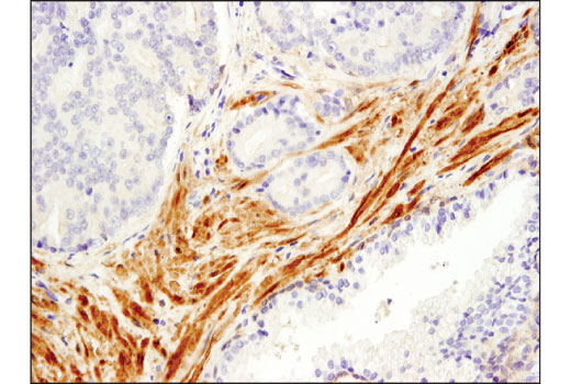 Immunohistochemistry Image 4: Palladin (D9H2) Rabbit Monoclonal Antibody