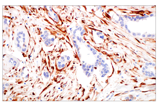 Immunohistochemistry Image 7: p16 INK4A (BC42) Mouse Monoclonal Antibody