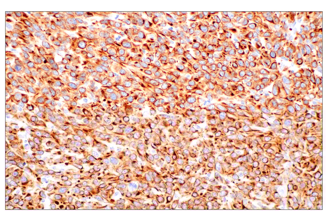 Immunohistochemistry Image 10: Pan-Keratin (Type I) (E6S1S) Rabbit Monoclonal Antibody
