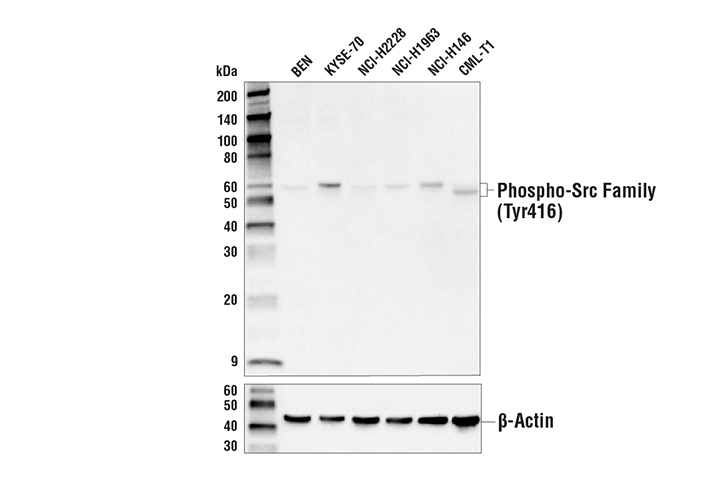 Western Blotting Image 3: Phospho-Src Family (Tyr416) (E6G4R) Rabbit Monoclonal Antibody