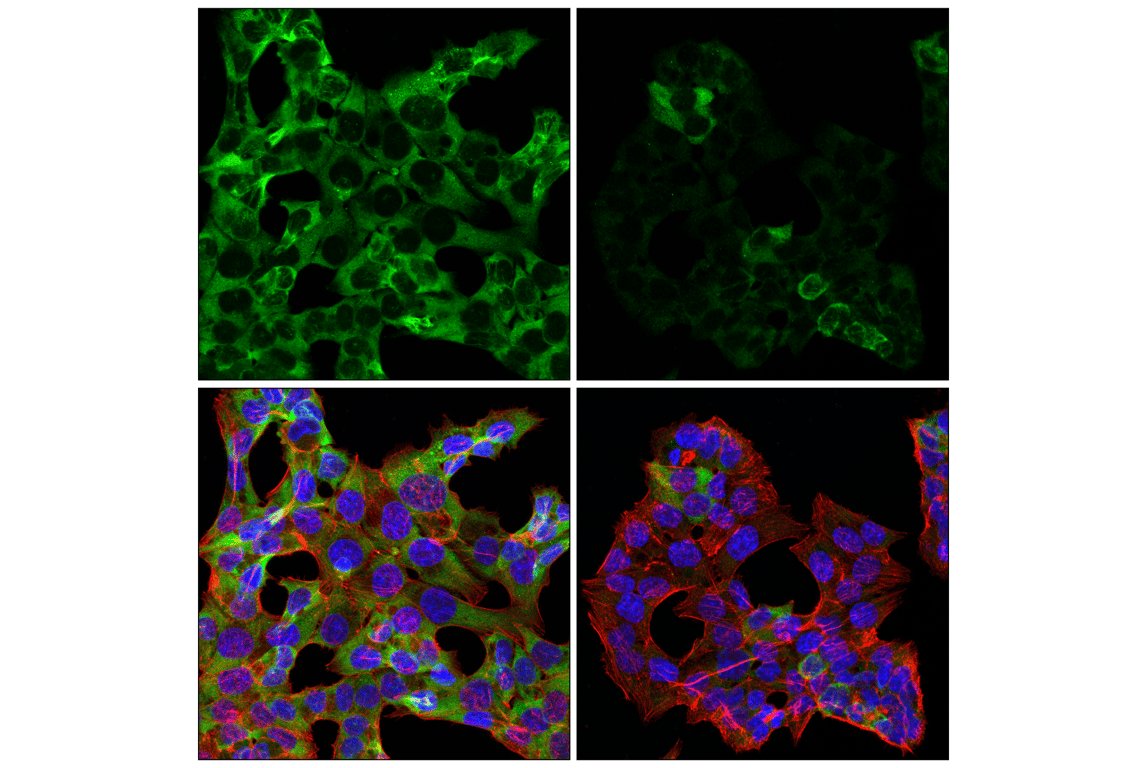 Immunofluorescence Image 2: G3BP2 (F3Y7Z) Mouse Monoclonal Antibody