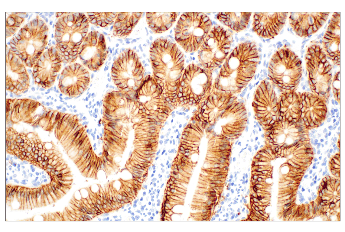 Immunohistochemistry Image 4: EpCAM (E6V8Y) Rabbit Monoclonal Antibody (BSA and Azide Free)