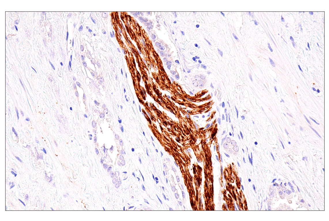 Immunohistochemistry Image 3: Neurofilament-M (E7L2T) Rabbit Monoclonal Antibody (BSA and Azide Free)