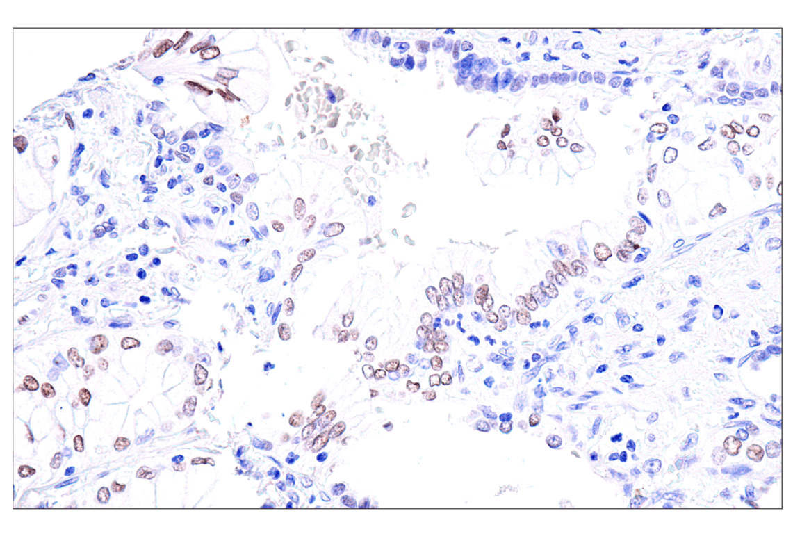 Immunohistochemistry Image 6: GATA-6 (D61E4) Rabbit Monoclonal Antibody