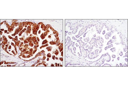 Immunohistochemistry Image 1: Phospho-EphA2 (Ser897) (D9A1) Rabbit Monoclonal Antibody