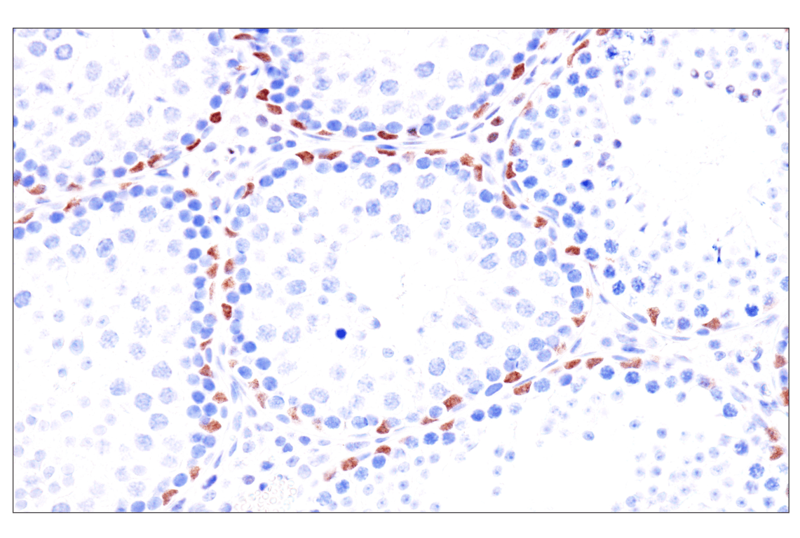 Immunohistochemistry Image 18: GATA-6 (D61E4) XP<sup>®</sup> Rabbit mAb (BSA and Azide Free)