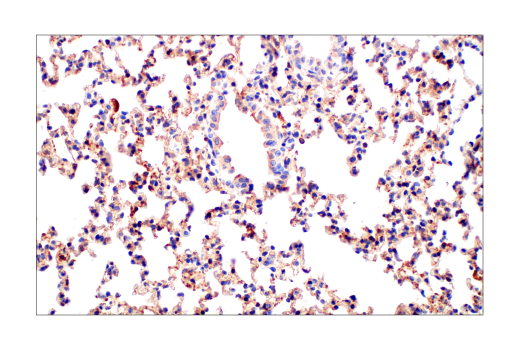 Immunohistochemistry Image 9: Src (36D10) Rabbit Monoclonal Antibody