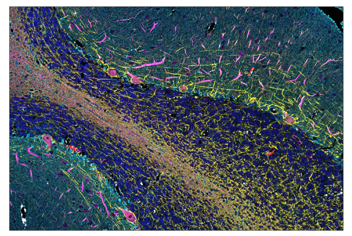 Immunohistochemistry Image 6: beta3-Tubulin (E9F3E) & CO-0128-750 SignalStar<sup>™</sup> Oligo-Antibody Pair