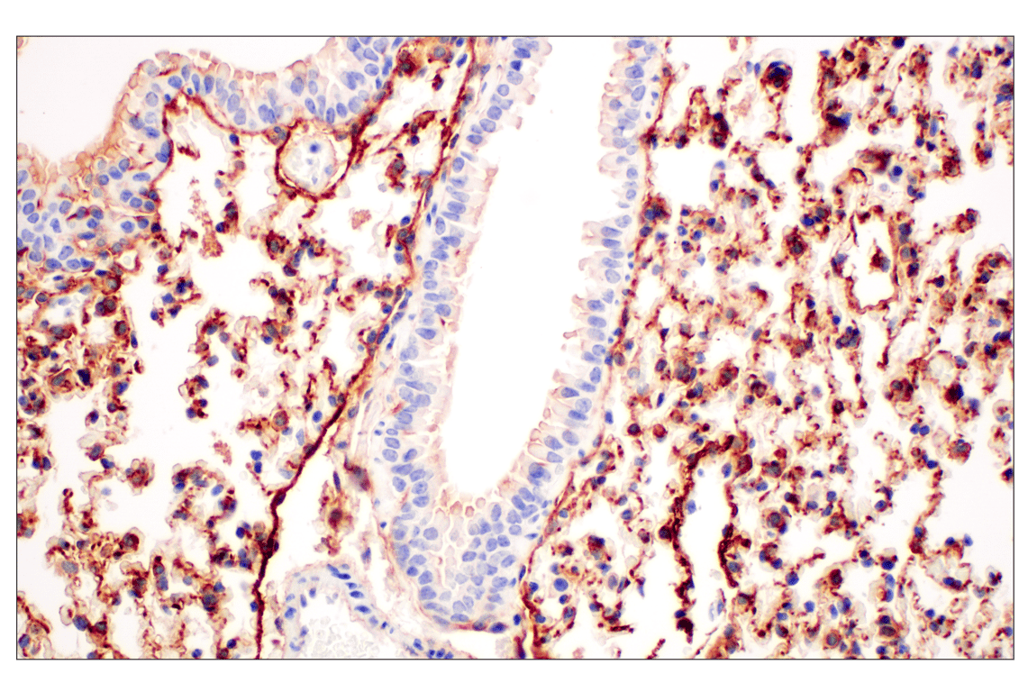 Immunohistochemistry Image 3: CD10/Neprilysin (F4P6H) Rabbit Monoclonal Antibody (BSA and Azide Free)