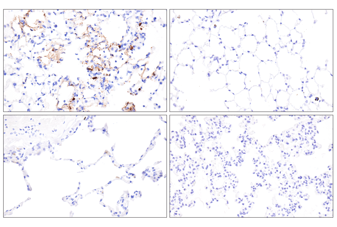 Nipah/Hendra virus Nucleocapsid (F5N9K) Rabbit Monoclonal Antibody