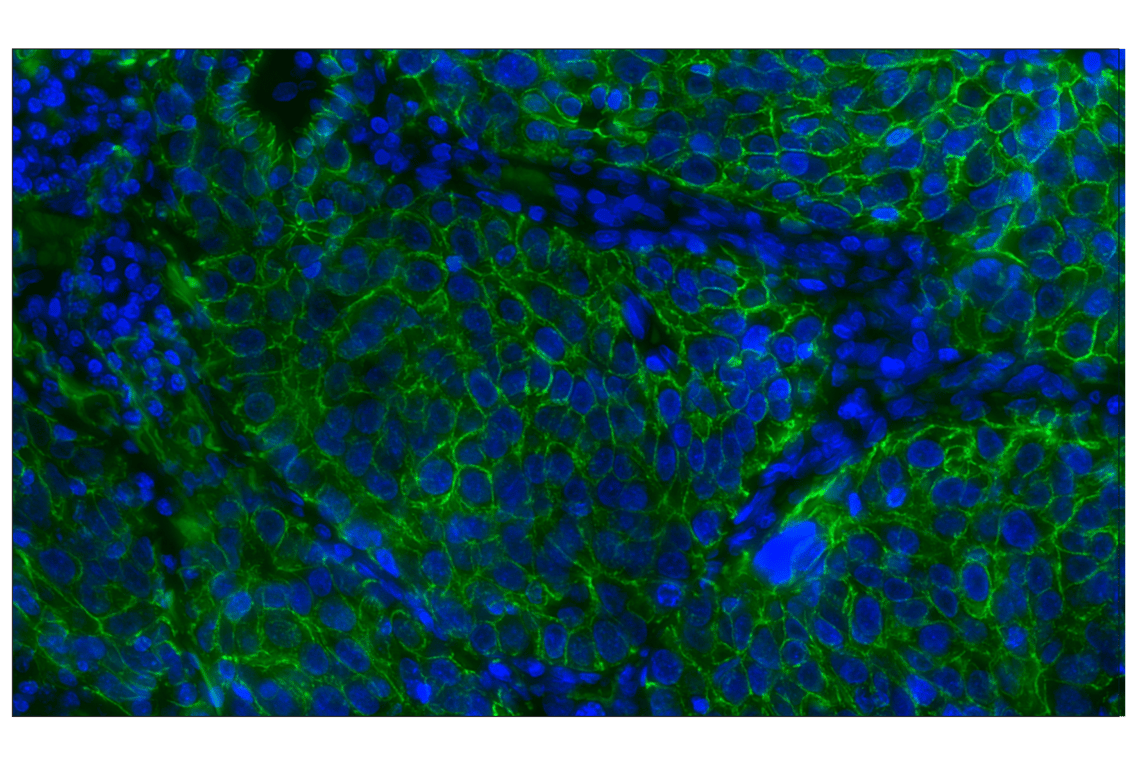 Immunohistochemistry Image 2: E-Cadherin (24E10) Rabbit Monoclonal Antibody (Alexa Fluor<sup>®</sup> 488 Conjugate)