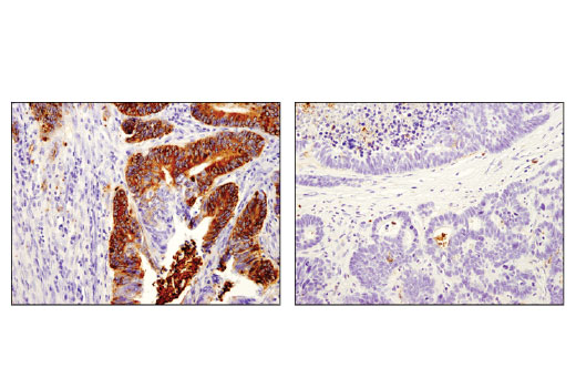 Immunohistochemistry Image 2: OLFM4 (D1E4M) Rabbit Monoclonal Antibody (BSA and Azide Free)