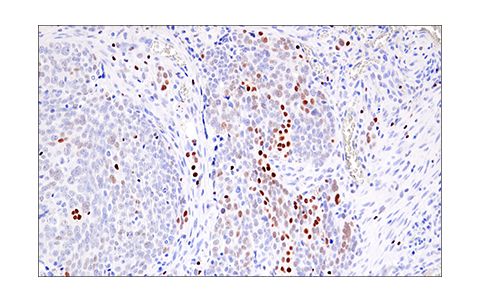 Immunohistochemistry Image 5: Helios (E4L5U) Rabbit Monoclonal Antibody (BSA and Azide Free)