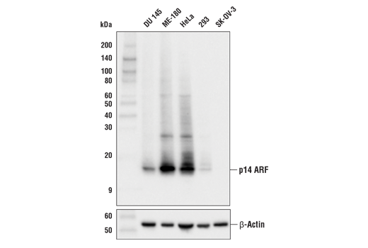 Western Blotting Image 1: p14 ARF (E3X6D) Rabbit mAb (BSA and Azide Free)