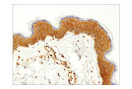 Immunohistochemistry Image 1: beta2-microglobulin (D8P1H) Rabbit Monoclonal Antibody (BSA and Azide Free)