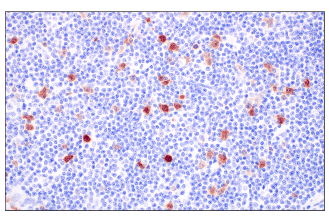 【再出品】melanin Na,K-ATPase β1 (D8W8J) Rabbit mAb | Cell Signaling Technology