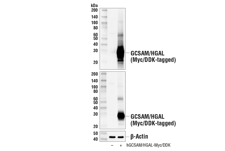 Western Blotting Image 2: GCSAM/HGAL (E7V1W) Rabbit Monoclonal Antibody