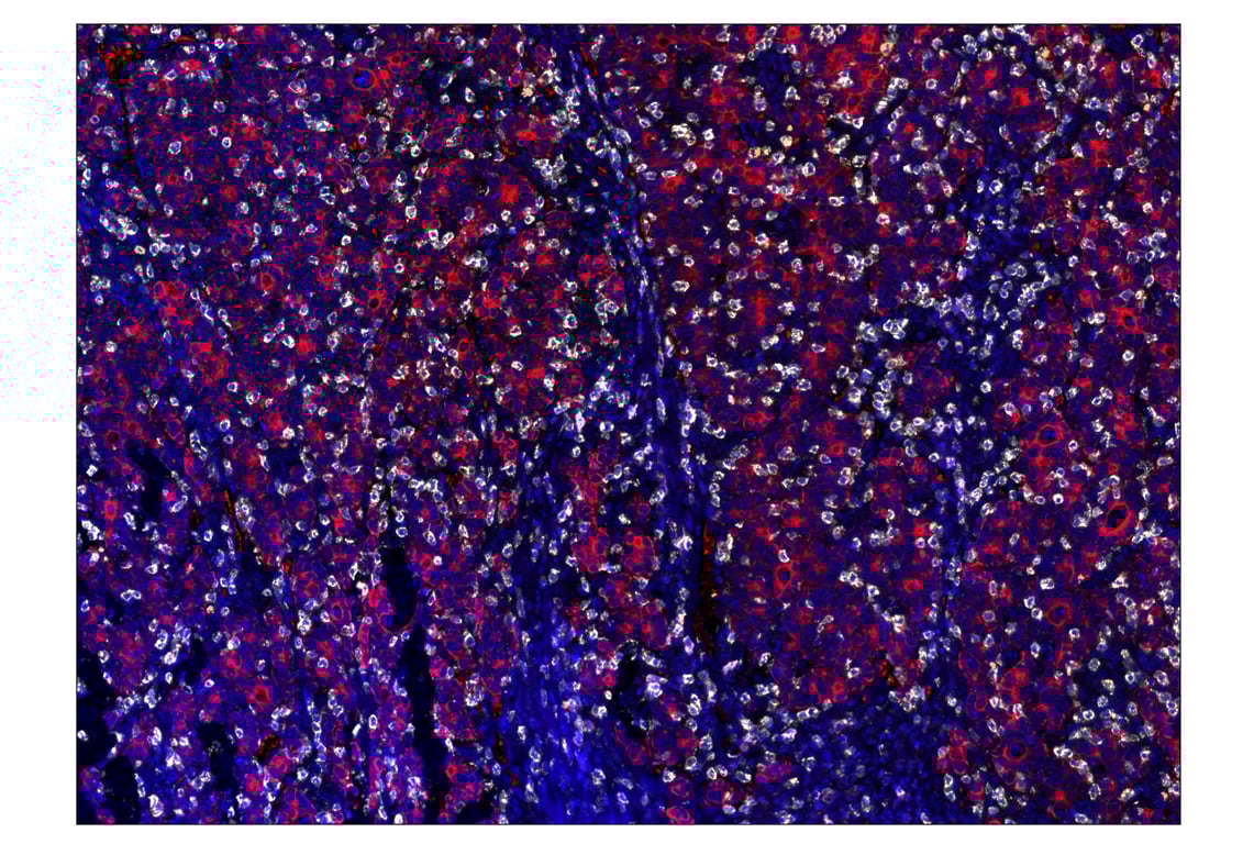 Immunohistochemistry Image 7: CD20 (E7B7T) & CO-0011-488 SignalStar<sup>™</sup> Oligo-Antibody Pair