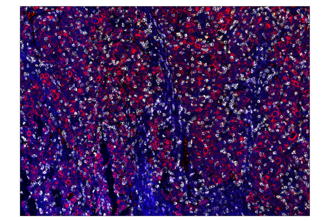 Immunohistochemistry Image 7: CD20 (E7B7T) & CO-0011-594 SignalStar<sup>™</sup> Oligo-Antibody Pair