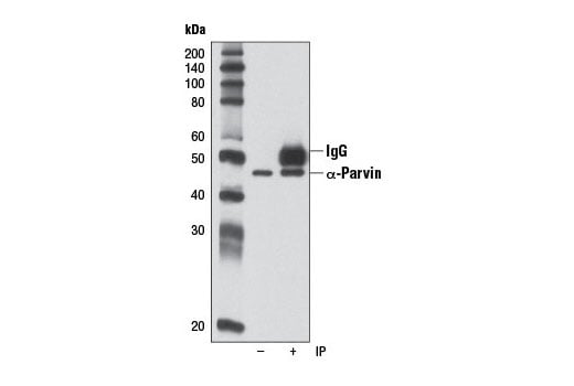 Immunoprecipitation Image 1: alpha-Parvin (D7F9) Rabbit Monoclonal Antibody