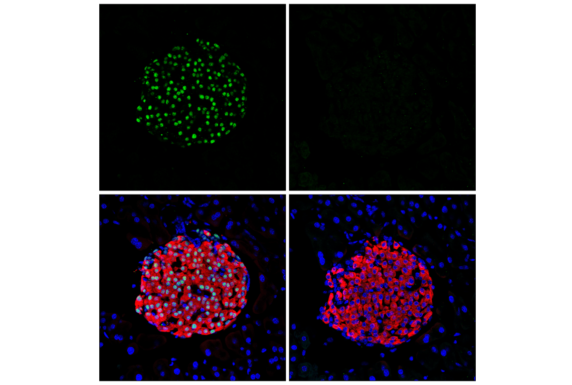 undefined Image 14: PhosphoPlus<sup>®</sup> NeuroD1 (Ser274) Antibody Duet