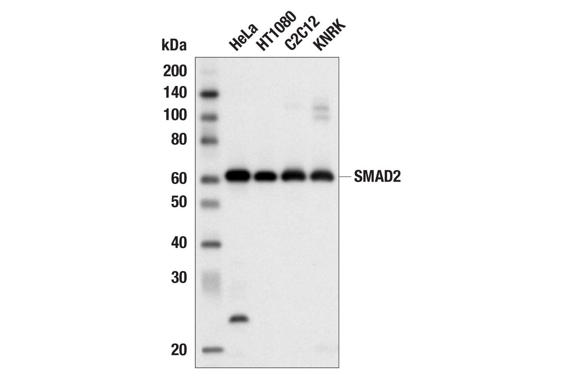 Western Blotting Image 2: SMAD2 (D43B4) Rabbit Monoclonal Antibody (Biotinylated)