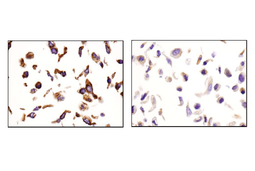 Immunohistochemistry Image 3: IGF-II Receptor/CI-M6PR (D8Z3J) Rabbit Monoclonal Antibody