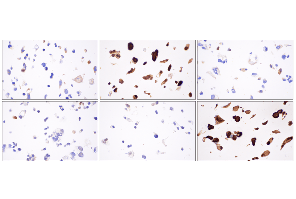 Immunohistochemistry Image 7: YAP (D8H1X) Rabbit Monoclonal Antibody