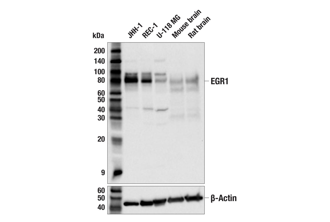 Western Blotting Image 2: EGR1 (44D5) Rabbit Monoclonal Antibody