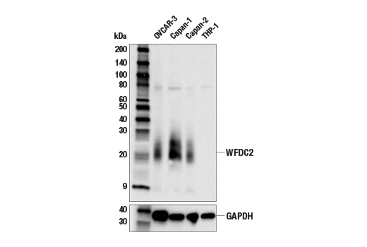 Western Blotting Image 2: WFDC2 (E8S8Z) Rabbit Monoclonal Antibody