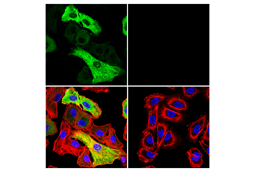 Immunofluorescence Image 1: SARS-CoV-1/2 Nucleocapsid Protein (1C7C7) Mouse Monoclonal Antibody
