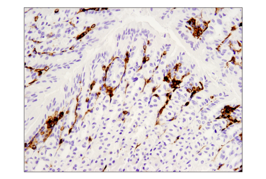 Immunohistochemistry Image 2: CD45 (D3F8Q) Rabbit Monoclonal Antibody (BSA and Azide Free)