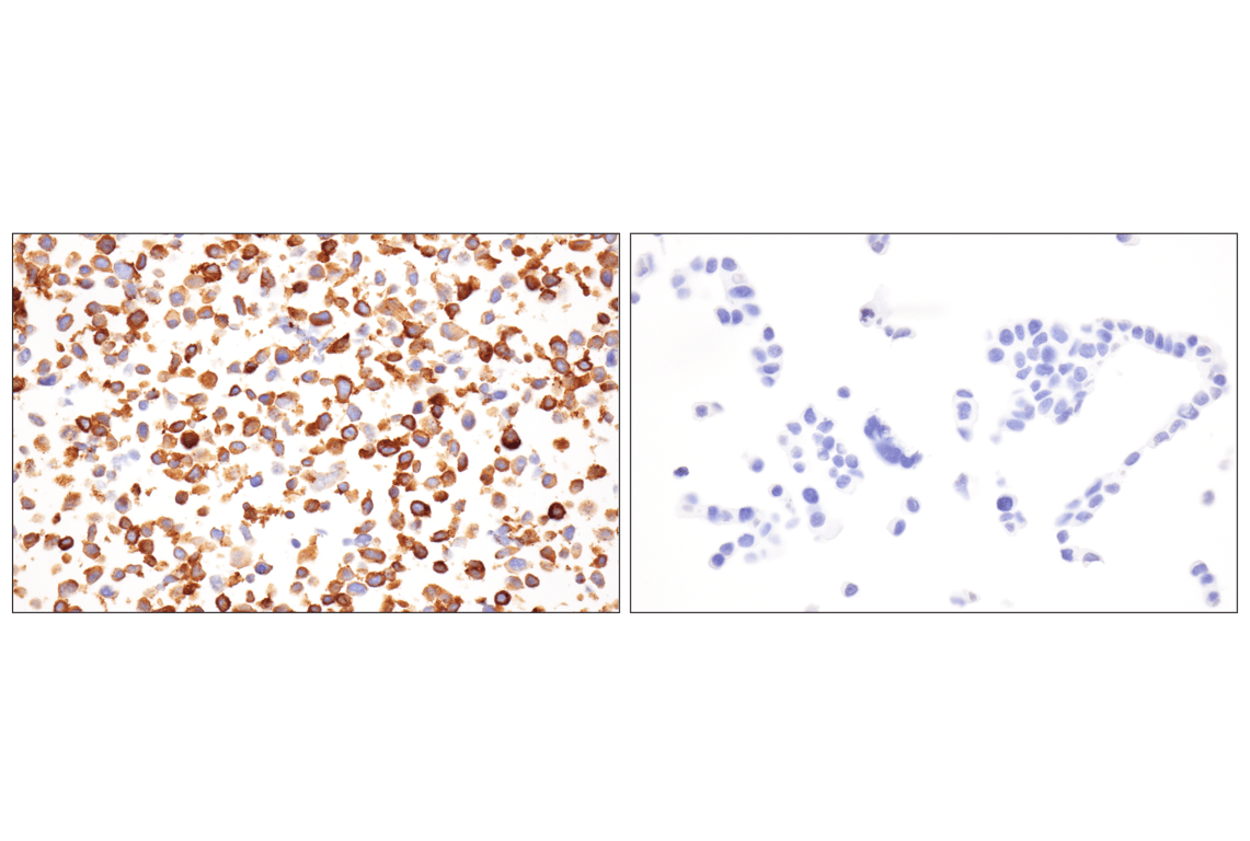 Immunohistochemistry Image 5: Angiomotin (F7W8U) Rabbit Monoclonal Antibody
