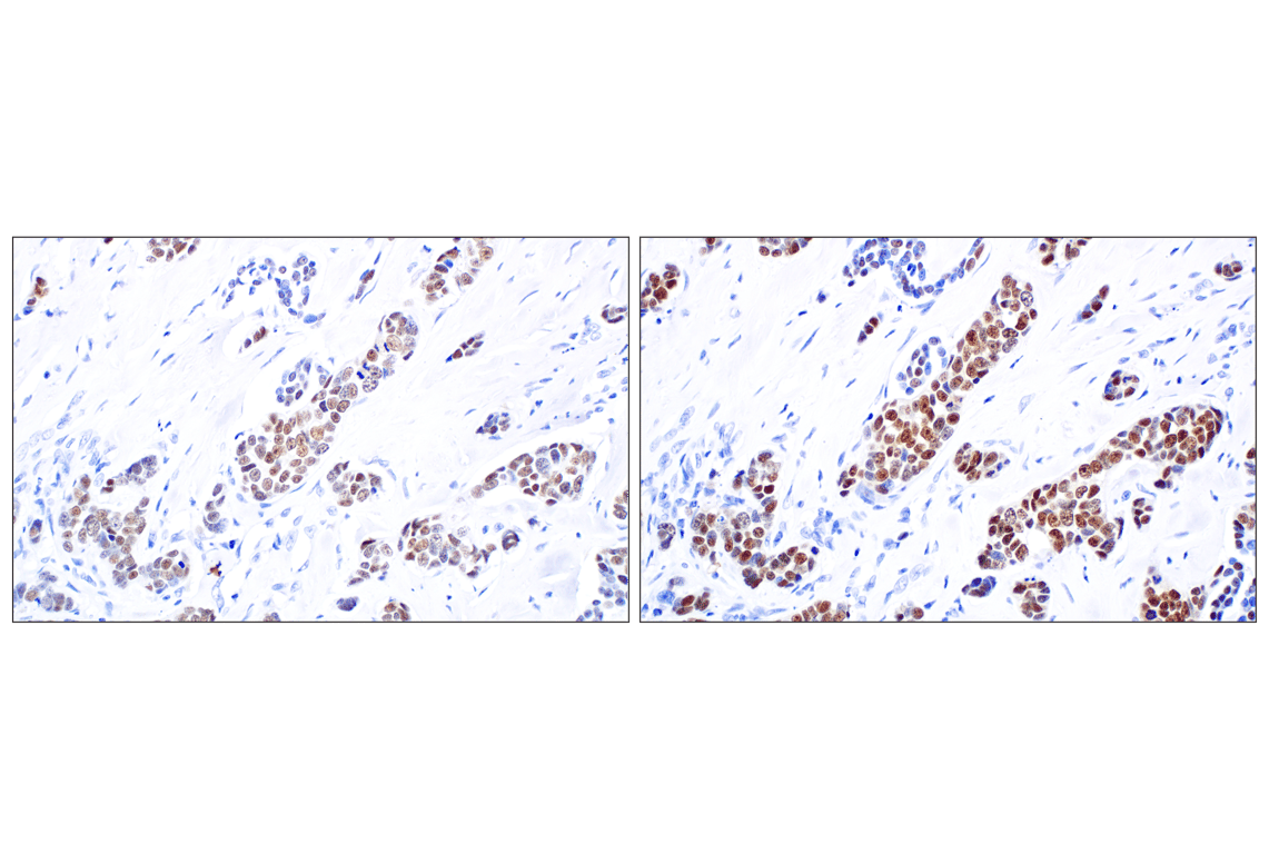 Immunohistochemistry Image 9: Sox10 (E2V9N) Rabbit Monoclonal Antibody (BSA and Azide Free)